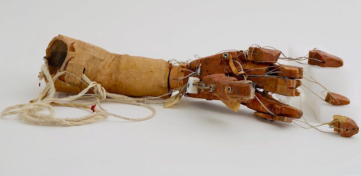 prosthetic_arm_with_strings_bg-e1685623890240